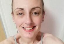 Пандемия COVID-19 спасла находившуюся на грани смерти из-за анорексии женщину