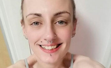 Пандемия COVID-19 спасла находившуюся на грани смерти из-за анорексии женщину